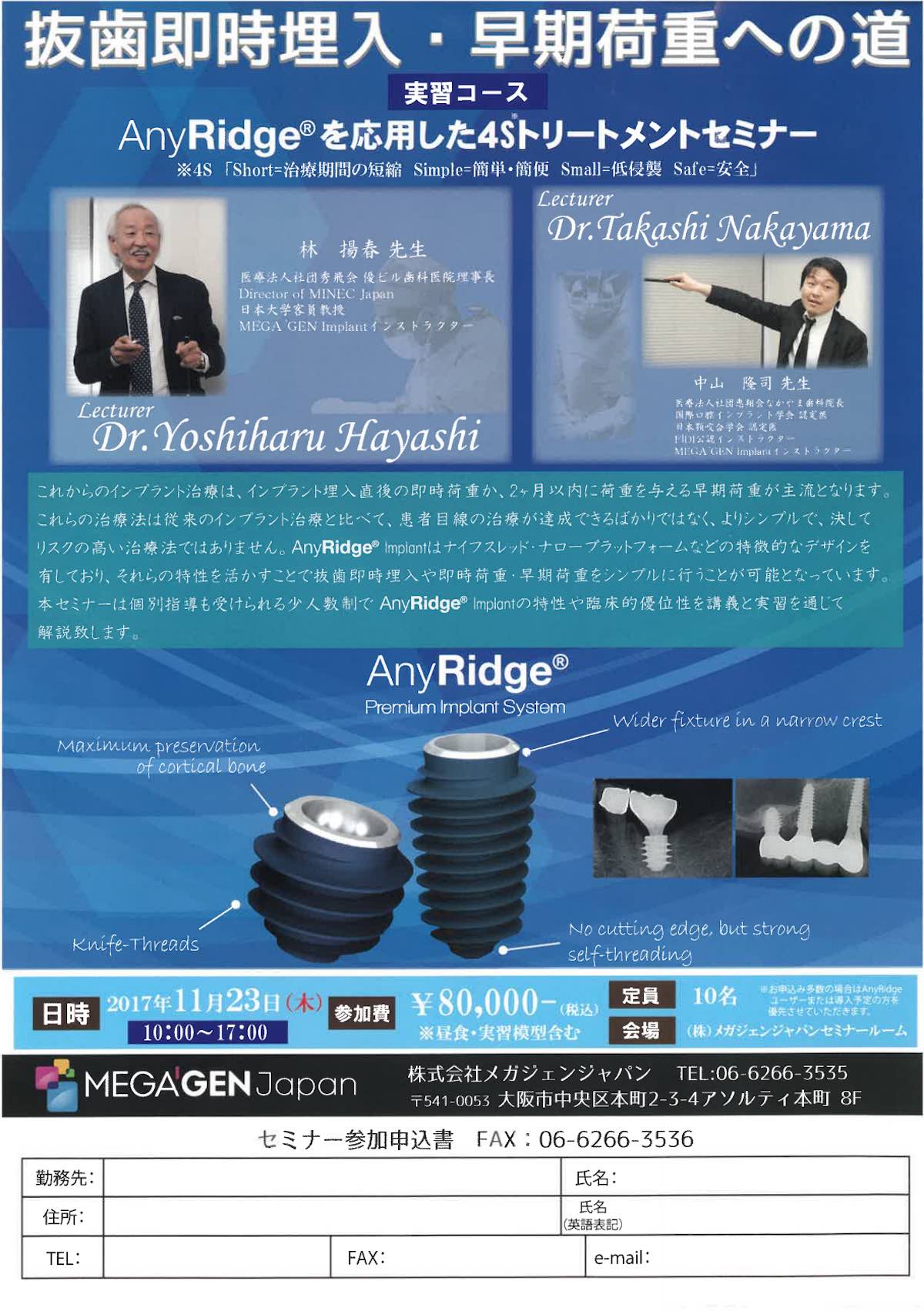 【歯科医師向け情報】【2017/11/23 大阪】 】｢AnyRidgeを応用した4Sトリートメントセミナー｣実習コースの講師を務めます