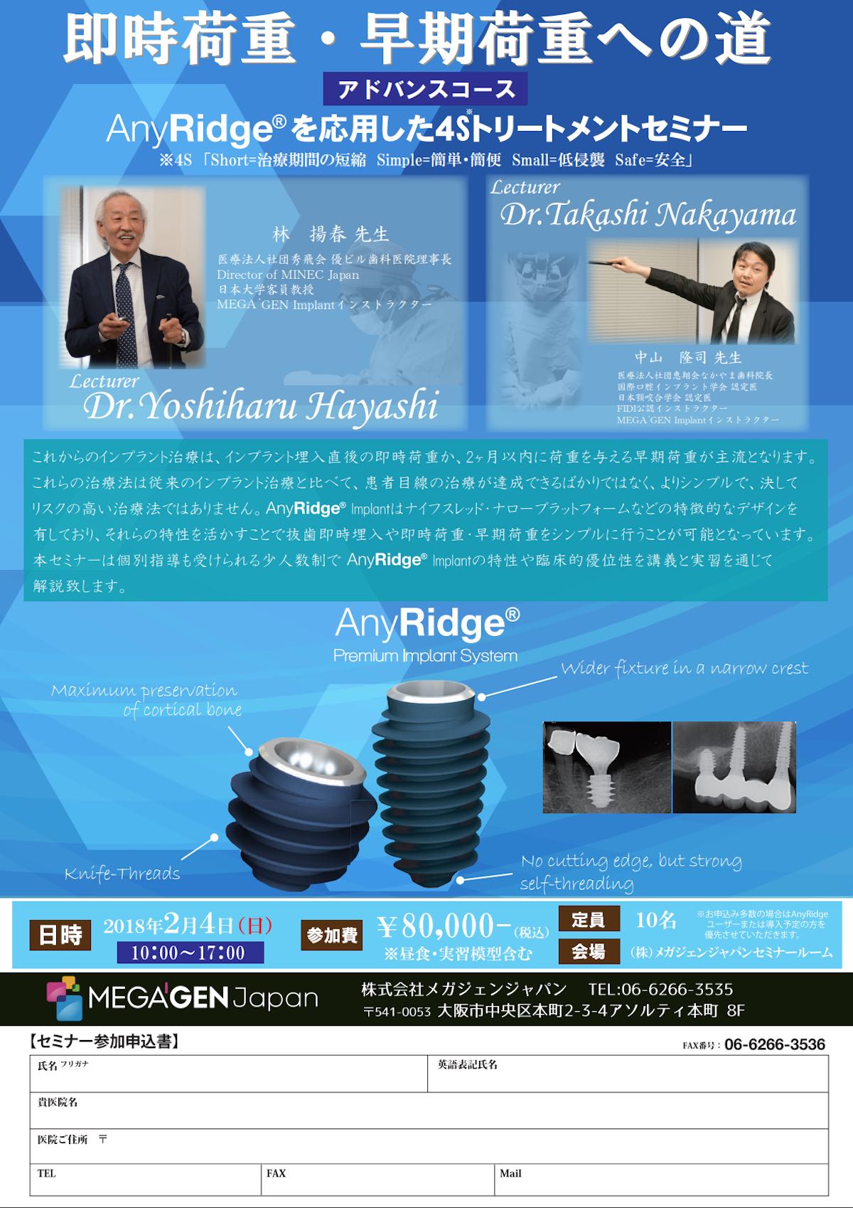 【歯科医師向け情報】【2018/2/4 大阪】 】｢AnyRidgeを応用した4Sトリートメントセミナー｣アドバンスコースの講師を務めます