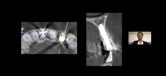 2020年5月、院長中山が歯科医師向けオンライン講座の講師を務めました