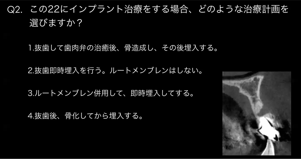 「美しさにこだわる前歯のインプラント治療」をテーマにしたオンラインセミナーで当院院長中山が講師を務めました