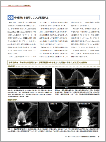 当院院長が信頼する先生方とともに 歯科医師向け専門書を執筆しました