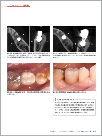 当院院長が信頼する先生方とともに 歯科医師向け専門書を執筆しました